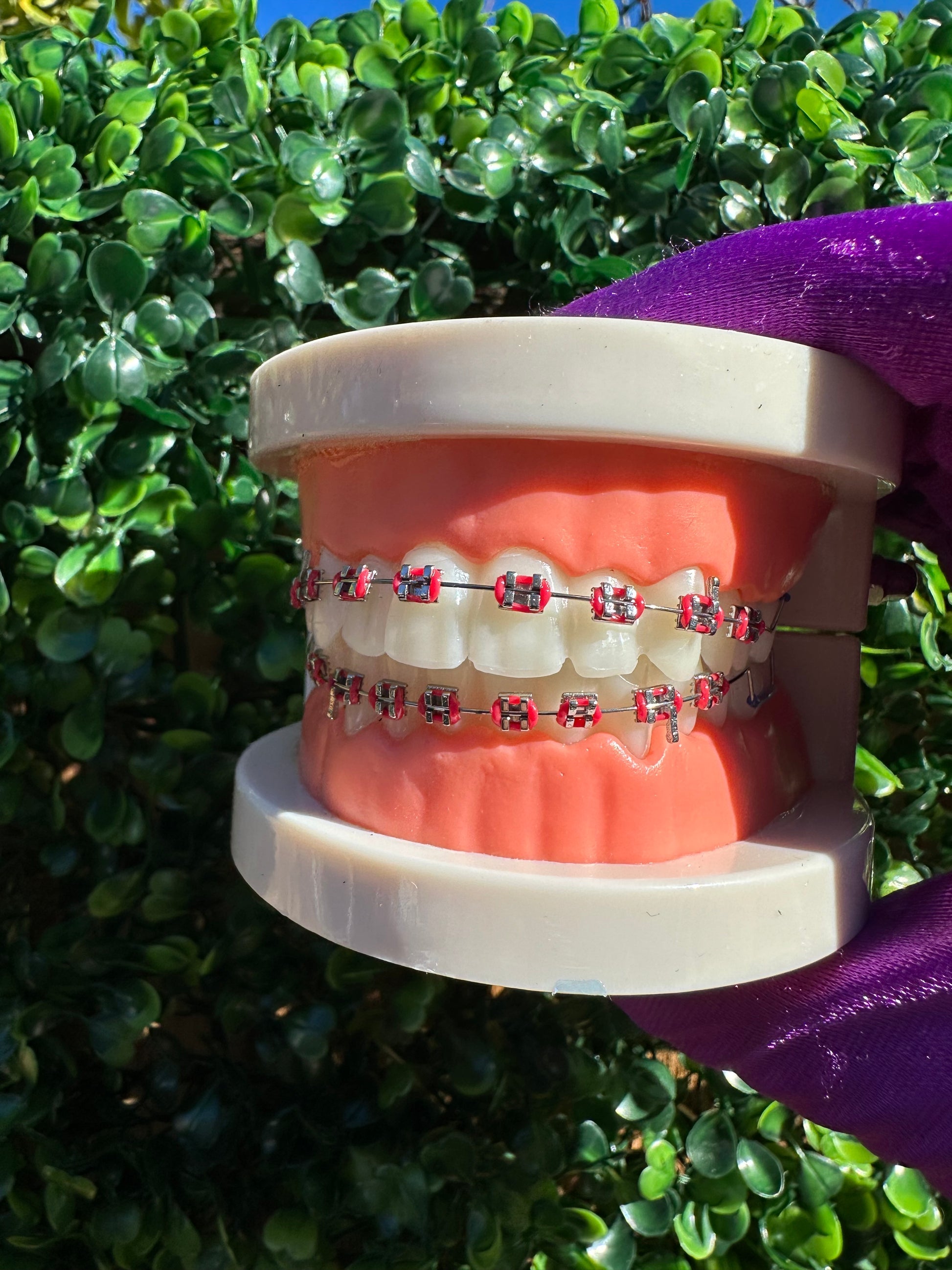 Olinaa® Clip-on Braces