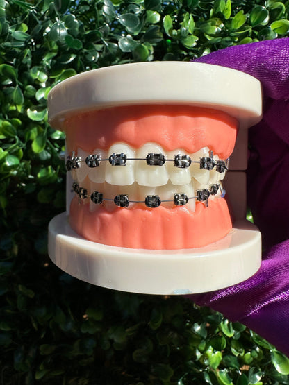 Olinaa® Clip-on Braces
