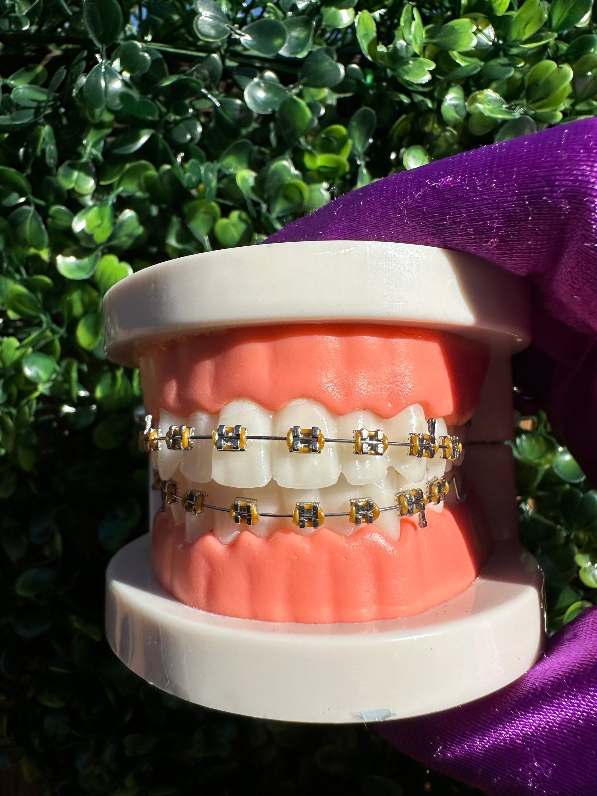 Olinaa® Clip-on Braces