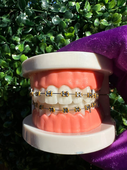 Olinaa® Clip-on Braces