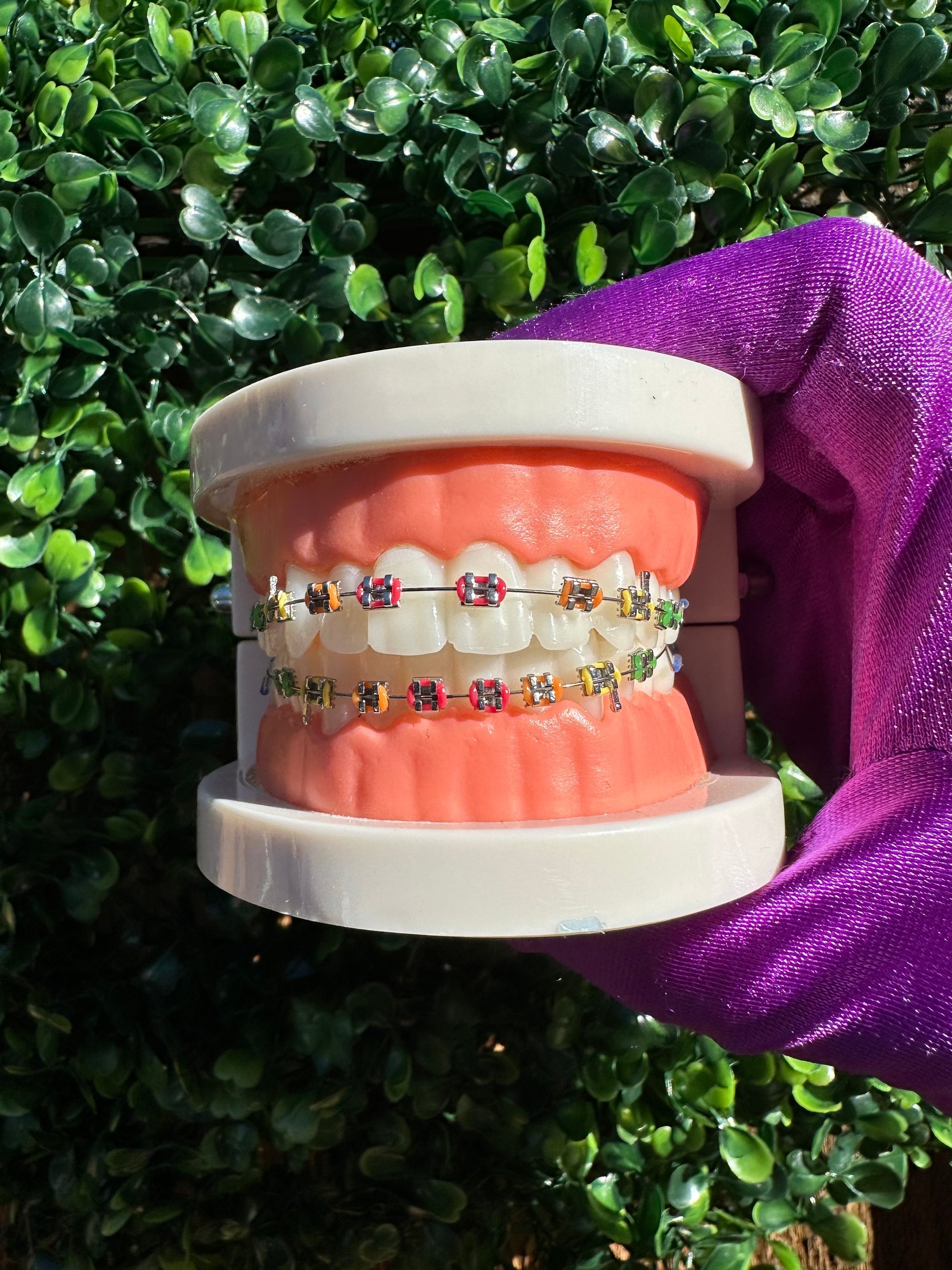 Olinaa® Clip-on Braces