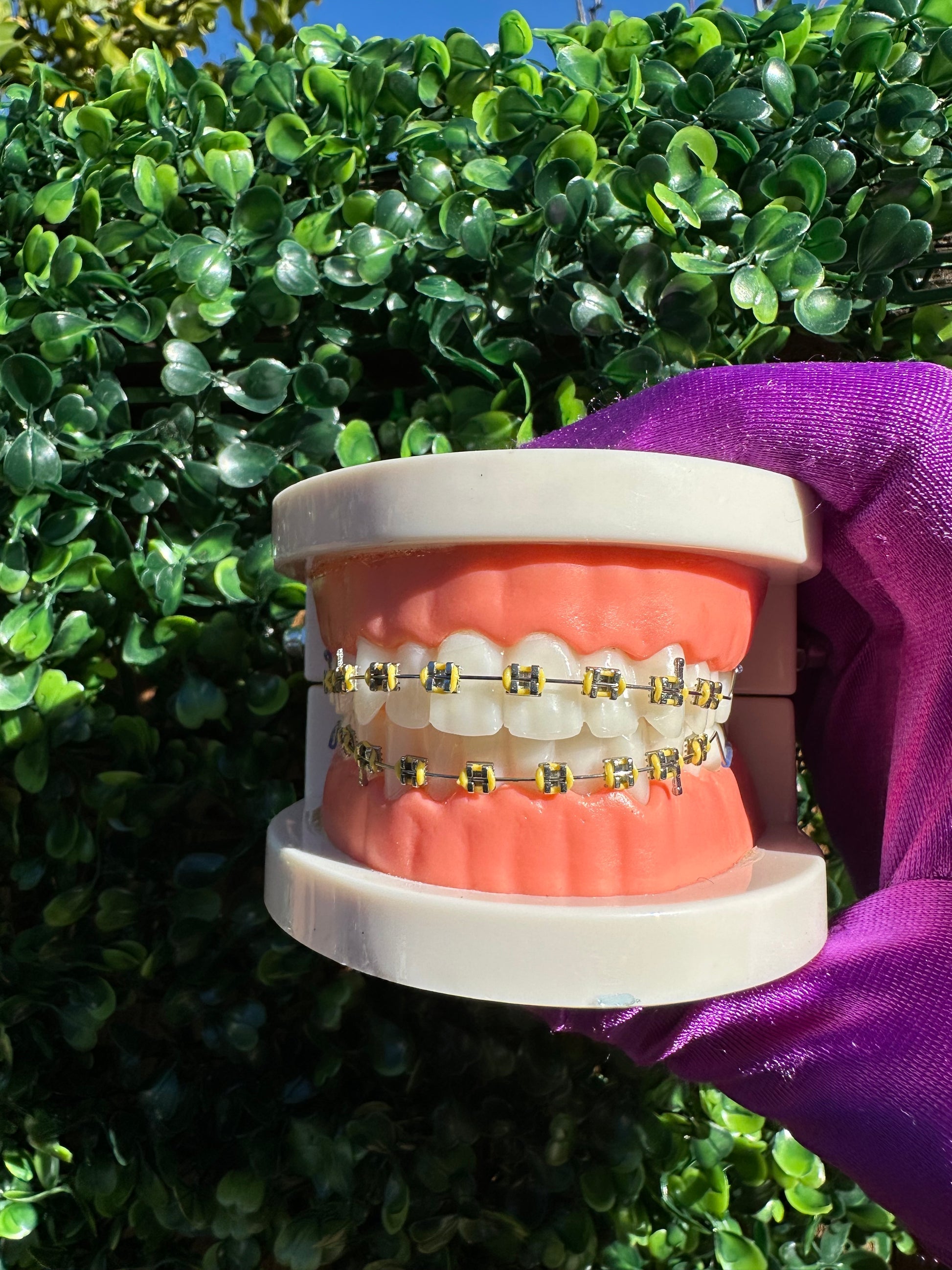 Olinaa® Clip-on Braces