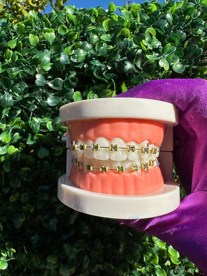 Olinaa® Clip-on Braces