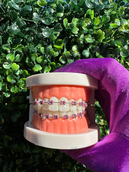 Olinaa® Clip-on Braces