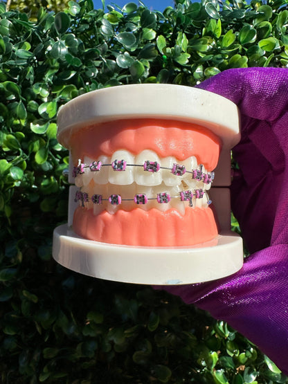 Olinaa® Clip-on Braces