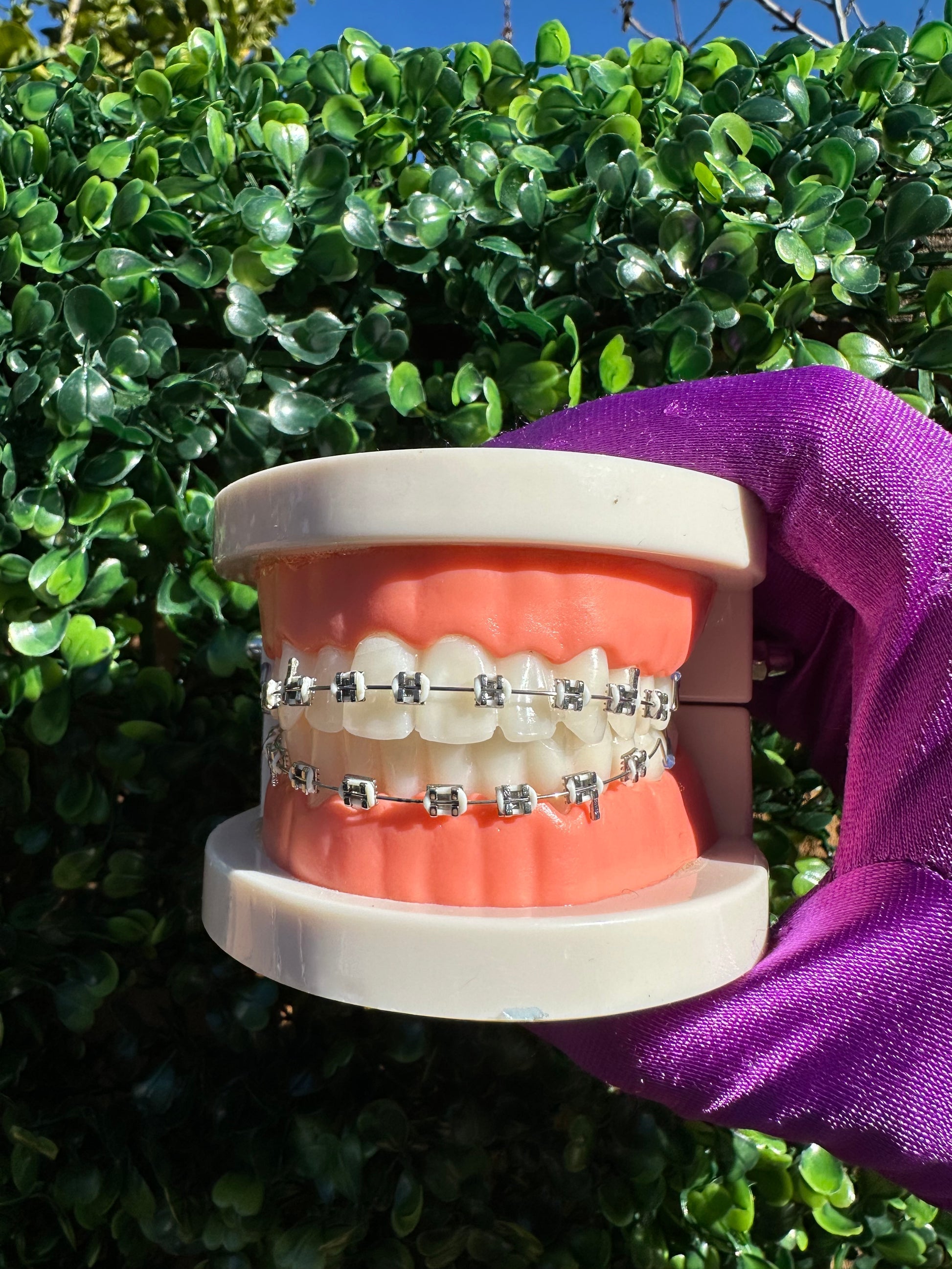 Olinaa® Clip-on Braces