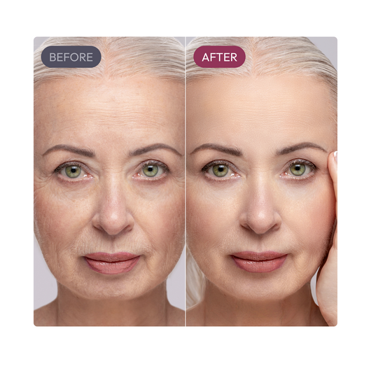 Olinaa® Madeca Cream (Anti-Aging)