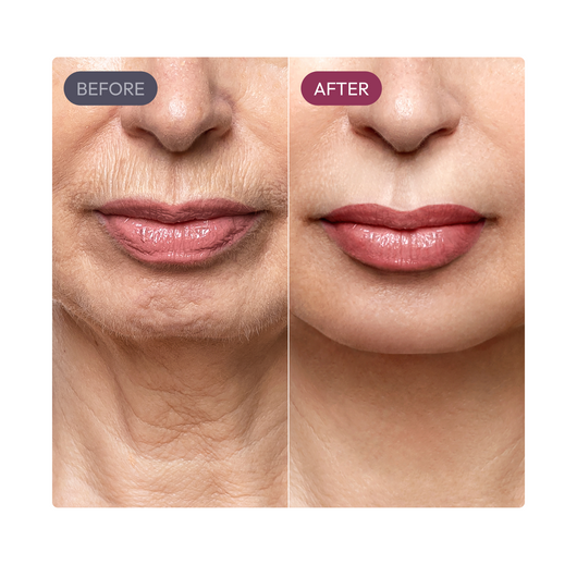 Olinaa® Madeca Cream (Anti-Aging)