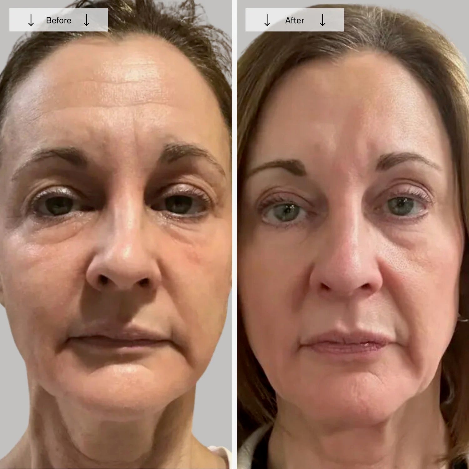 Luxera Contour Face