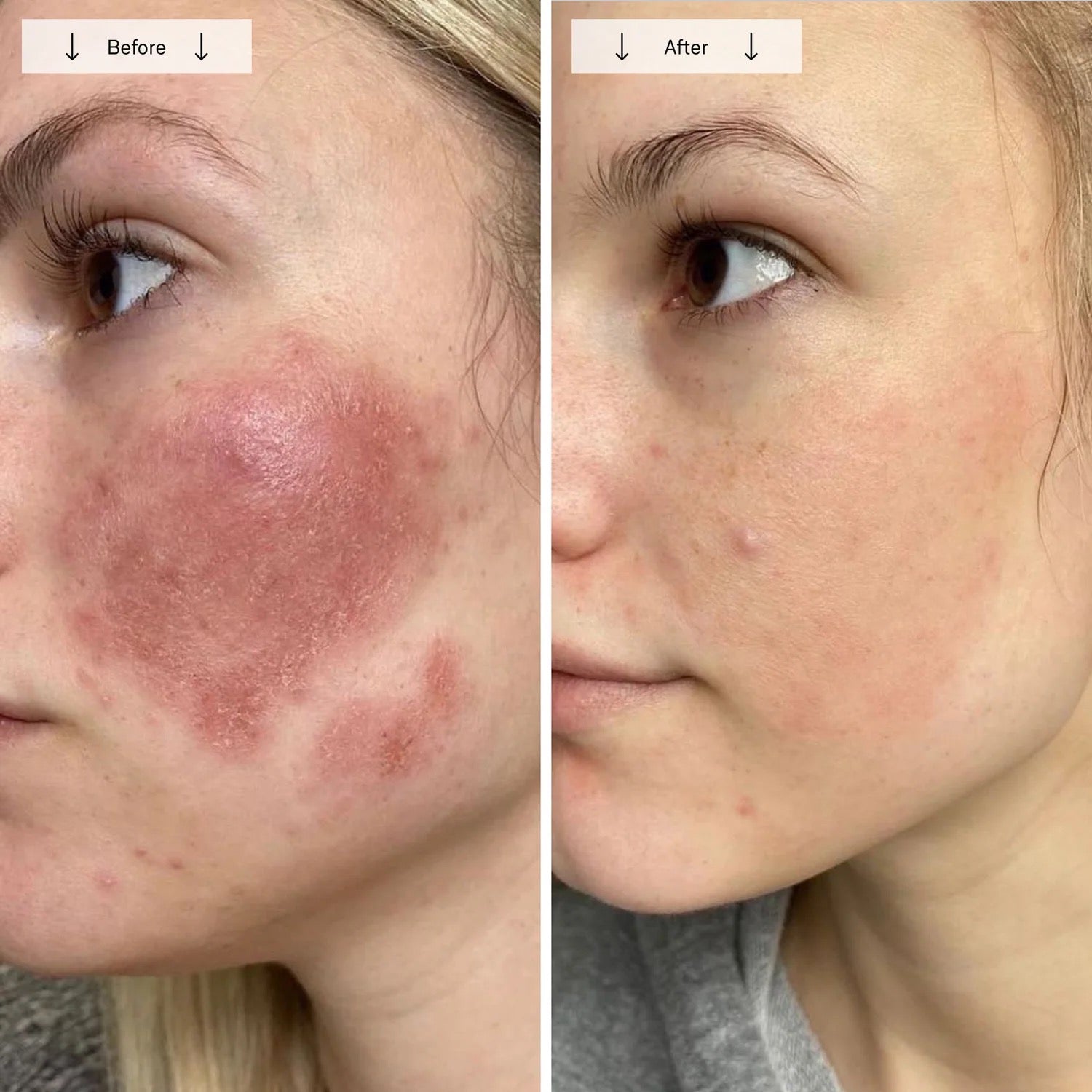 Luxera Contour Face