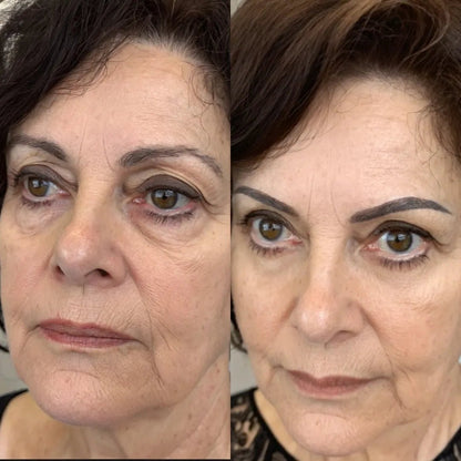 RevitaEyes® 2-in-1 Red Light Therapy + EMS To Erase Eye Bags