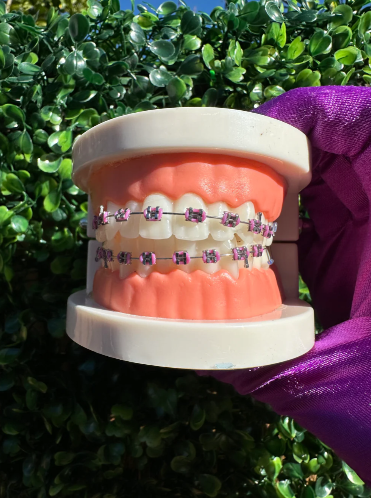 Olinaa® Clip-on Braces