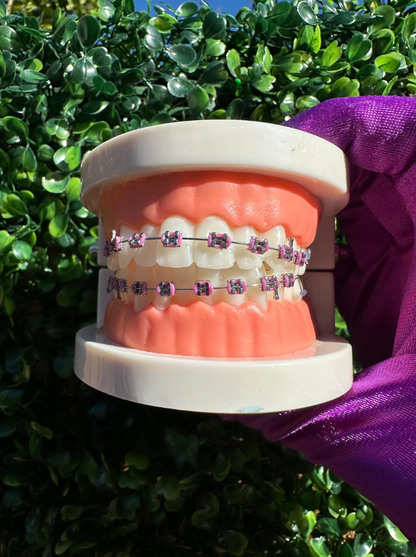 Olinaa® Clip-on Braces