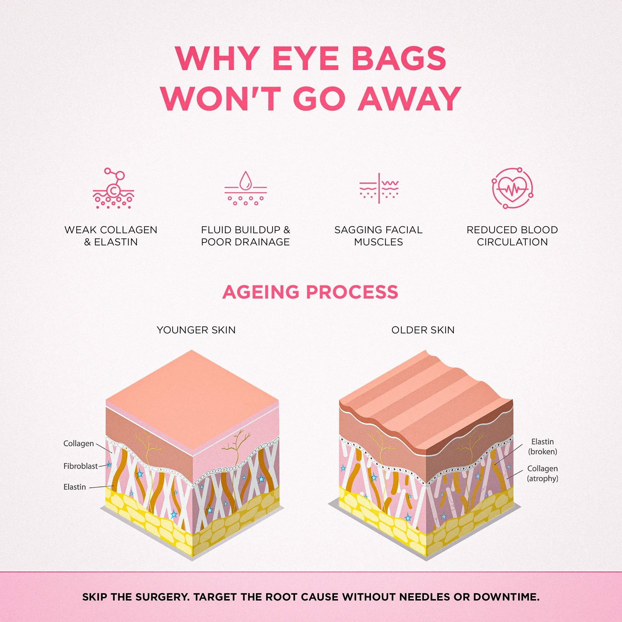 RevitaEyes® 2-in-1 Red Light Therapy + EMS To Erase Eye Bags