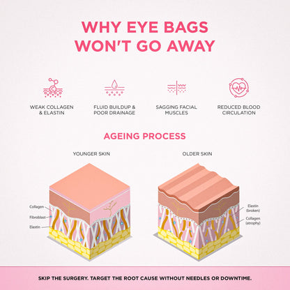 RevitaEyes® 2-in-1 Red Light Therapy + EMS To Erase Eye Bags